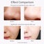 Ultrasonic Skin Scrubber Deep Face Cleaning Machine-06014 Carousel 9