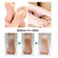 Foot Cleaner - Electric Scar Remover, Rechargeable Foot File, Pedicure Tool Carousel 4