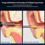 Portable Intelligent Ear Wax Removal Tool Visual Otoscope Earwax Picker Free Shi Carousel 5