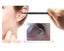 Ear Endoscope Clearance - Clearance Carousel 4