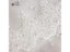DIY Fabric Lace Black White Sweet Cordate Lace Trim DIY Craft Materials Carousel 1
