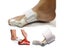 1pc Bunion Splint Big Toe Straightener Corrector Hallux Valgus Foot Pain Relief Carousel 2