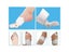 1pc Bunion Splint Big Toe Straightener Corrector Hallux Valgus Foot Pain Relief Carousel 7