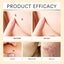 New Skin Tag Remover Afterpay Carousel 4