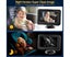 Car Baby Monitor, Surveillance Monitor, 4.3 Inch Camera Monitor Set, 360 De Carousel 3