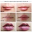 Lip Enhancer Carousel 4
