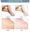 Bellezon Underarm Whitening Cream Carousel 3