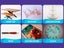 gallery view thumbnail