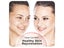 LED Light Therapy Face Mask Carousel 12