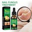 Ginger Nail Fungus Treatment Liquid Anti Fungal Growth Finger Toe Repair Carousel 1