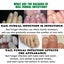 Ginger Nail Fungus Treatment Liquid Anti Fungal Growth Finger Toe Repair Carousel 3