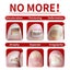 Ginger Nail Fungus Treatment Liquid Anti Fungal Growth Finger Toe Repair Carousel 7