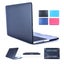 Loading Image 1 of 1