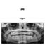 Loading Image 1 of 1