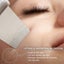 LCD Display Blackhead Scrubber - 2025 Version Carousel 5