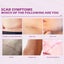 Stretch Mark Surgery Injury Acne Scar Removal Cream Carousel 6