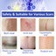 Silicone Scar Sheets Silicone Scar Tape Roll Scar Silicone Strips 4cm x 3m Carousel 4