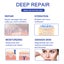 Silicone Scar Sheets Silicone Scar Tape Roll Scar Silicone Strips 4cm x 3m Carousel 5