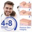 Silicone Scar Sheets Silicone Scar Tape Roll Scar Silicone Strips 4cm x 3m Carousel 12
