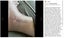 Silicone Scar Sheets Silicone Scar Tape Roll Scar Silicone Strips 4cm x 3m Carousel 15