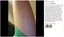 Silicone Scar Sheets, Silicone Scar Tape 4cm x 1.5m Carousel 3