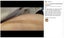 Silicone Scar Sheets, Silicone Scar Tape 4cm x 1.5m Carousel 4
