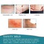 Silicone Scar Sheets, Silicone Scar Tape 4cm x 1.5m Carousel 6