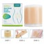 Silicone Scar Sheets, Silicone Scar Tape 4cm x 1.5m Carousel 7
