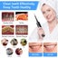 Ultrasonic Tooth Cleaner Plaque Remover Kit NZ Clearance Sale Carousel 12