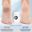 New Electric Foot Callus Remover Sale Sale Carousel 7