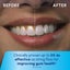 Waterpik Cordless 1100 Rechargeable Portable Water Flosser Carousel 4