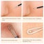 5pcs Professional Acne Blackhead Remover Pimple Comedone Extractor Kit Carousel 3
