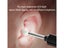Ear Cleaning Endoscope NZ Clearance Carousel 6