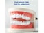 8 x Teeth Protector Dental Mouth Night Guard for Teeth Grinding Carousel 9