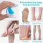 6 Pair Gel Arch Support Insoles Silicone Orthotic Heel Insert Cushion Plantar... Carousel 2