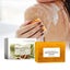 Kojic Acid Soap Turmeric Soap 1PC Dark Spot Remover for Face and Body Bath Soap Carousel 1