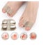 1 Pair Orthopedic Bunion Correction Toe Separators Carousel 2