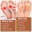 Callus Pads for Feet Soft Felt Callus Cushions for Bottom of Foot Relief Ad Carousel 5