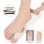 1 Piece Big Toe Pain Relief Straightener - Sebs Cross Strap Separator - Non-S... Carousel 7