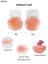 Women's M Silicone Self-Adhesive Bra with Breast Lift Tape, Flower & Round Carousel 3