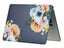 Macbook Air 15" (M3, 2024) A3114 Designer Hard Case [Flower] Carousel 4