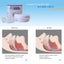 Adjustable Braces For Anti Bruxism Teeth At Night Carousel 4