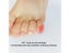 Soft Silicone Toe Caps Pain Relief Anti-Friction Breathable Toe Protector Carousel 6