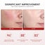 3PCS Koriderm Time Reverse Cream, Koriderm Cream For Face For All Skin Types Carousel 3