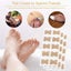 100PCS Glue Free Toenail Toe Ingrown Nail Correction Patch Sticker Foot Care Carousel 6
