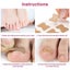 100PCS Glue Free Toenail Toe Ingrown Nail Correction Patch Sticker Foot Care Carousel 11