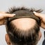 Superior Hair NZ Carousel 7