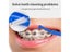 Interdental Brush For Orthodontic Braces Micro Soft L Shaped Carousel 5