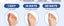 2PCS Bunion Corrector Toe Alignment Corrector with Splint & Pads Carousel 5