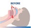 Anti Snore Guard Device Stop Snoring Mouthpiece anti-snoring Mouthguard Carousel 12
